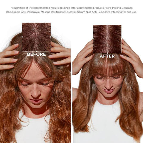 Kérastase Symbiose Crème Hydrating Anti-Dandruff Scalp Shampoo 250ml bottle with creamy texture and label detail.