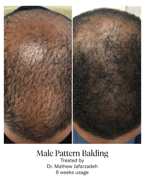 Calecim Structure Enhancing Conditioner 300ml