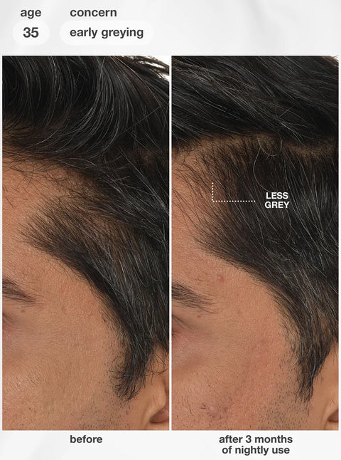 K18 FutureIQ™ biomimetic hair longevity serum 90ml