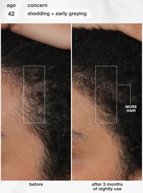 K18 FutureIQ™ biomimetic hair longevity serum 90ml