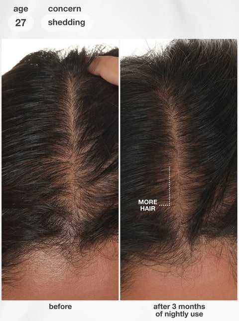K18 FutureIQ™ biomimetic hair longevity serum 90ml